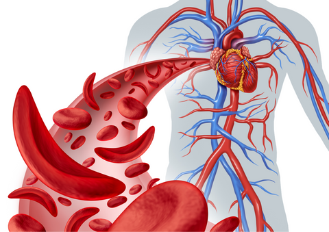 How to Improve Circulation: What Are the Causes of Low Circulation?